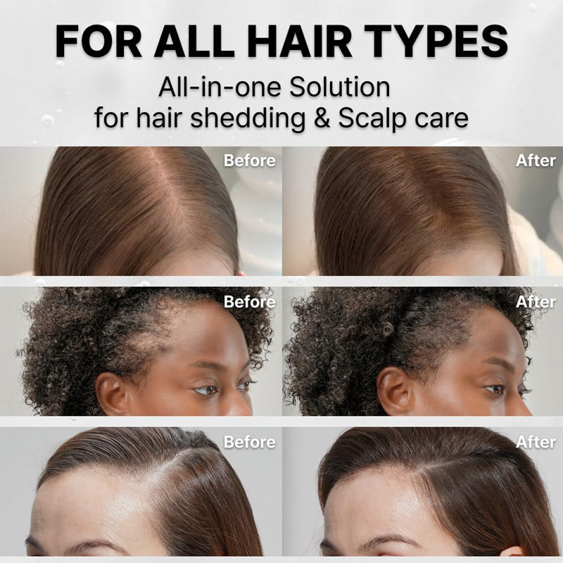 Venleox™ Hair Growth Scalp Serum